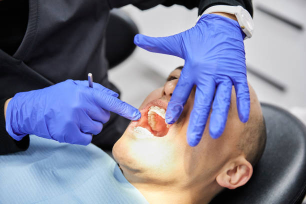 Best Teeth Whitening  in Shenandoah Junction, WV